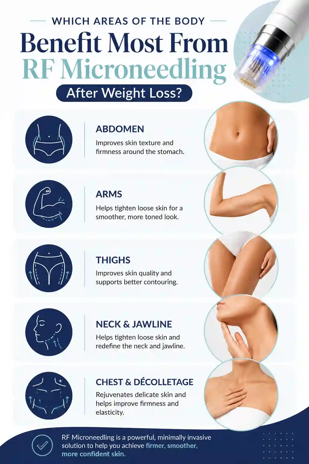 Which Areas of the Body Benefit Most From RF Microneedling After Weight Loss Cirencester